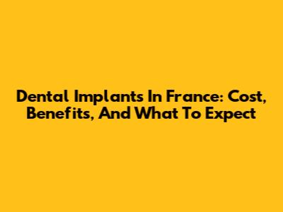 Dental Implants In France: Cost, Benefits, And What To Expect
